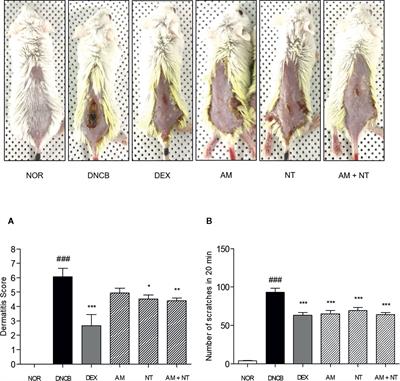 Ameliorative and Synergic Effects of Derma-H, a New Herbal Formula, on Allergic Contact Dermatitis